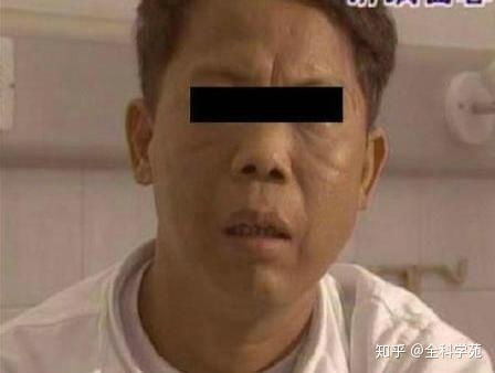 表情通过你的面相就可推测所得疾病你信知乎表情