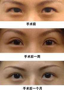 为什么大家都喜欢双眼皮