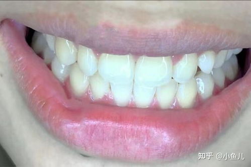叫女朋友起床的表情包烤瓷牙