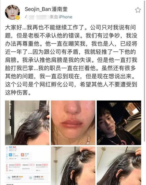 潘南奎秒删被打动态,面部红肿状态很差,粉丝心疼到落泪