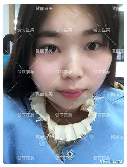 毕业就去做双眼皮,高中好友的表情亮了,这是