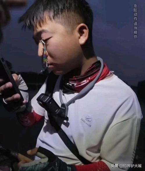 钓鱼要戴头盔河北男子把鱼钩飞到眼睛上,太危险了