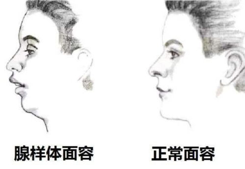 二尖瓣面容表情包扭曲