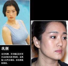 刘晓庆木偶脸揭穿女星不老神话真相