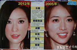 林志玲年近40极速救面脸似蜡像僵硬无表情
