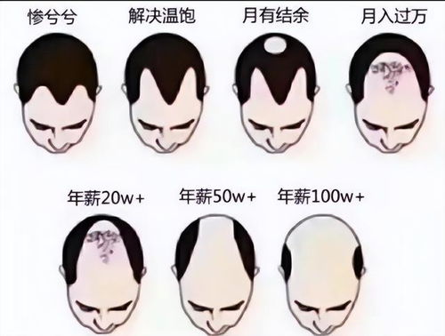 程序员在网上晒出了与领导吃饭时的照片哇哈哈哈哈