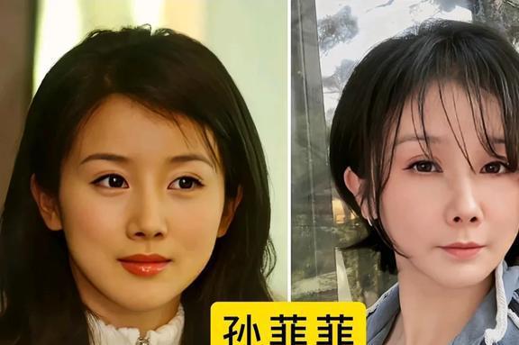 自毁前程式的变脸,她们明明长得那么美却偏偏想不开要整容