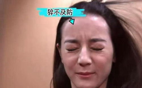 二尖瓣面容表情包强风