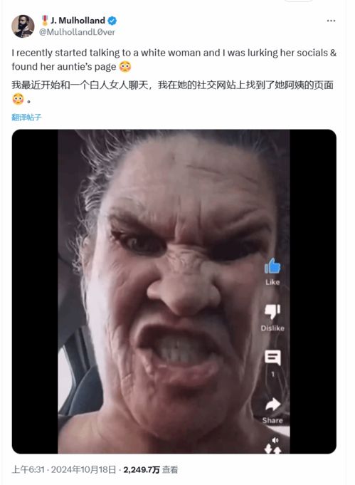 二尖瓣面容表情包动感