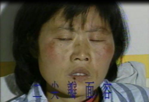 二尖瓣面容表情包老态