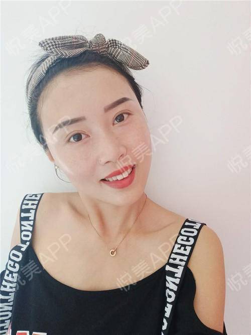我这个美丽双眼皮姐姐来啦,之前有妹妹说我自拍表情不...眼综合整形悦美整形