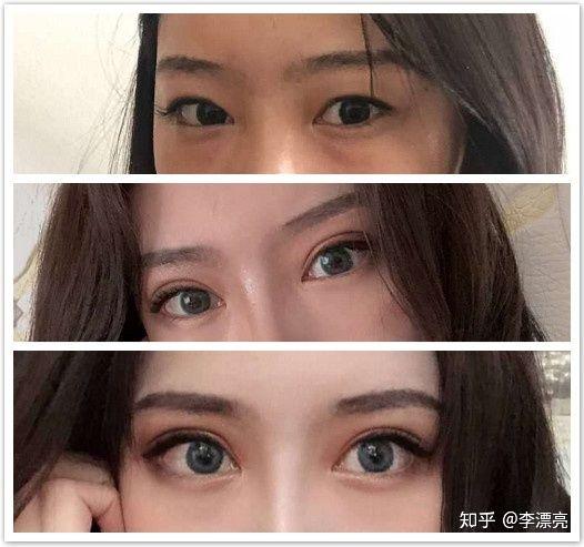 姐妹们,襄阳哪里割双眼皮比较好