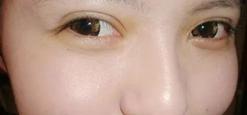 你的双眼皮为什么1秒就被看穿