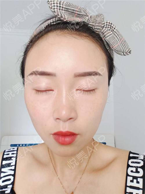 我这个美丽双眼皮姐姐来啦,之前有妹妹说我自拍表情不...眼综合整形悦美整形