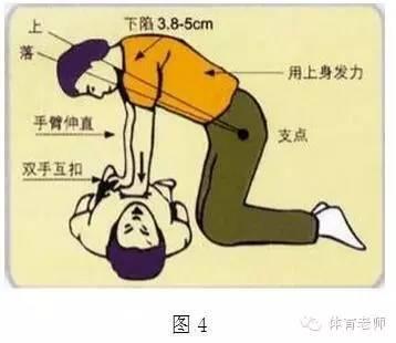 急救常识心脏复苏