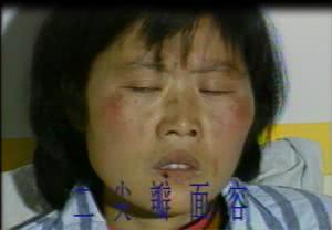 耳朵上如果出现这个症状,提醒您可能心脏出现问题,赶紧去做检查