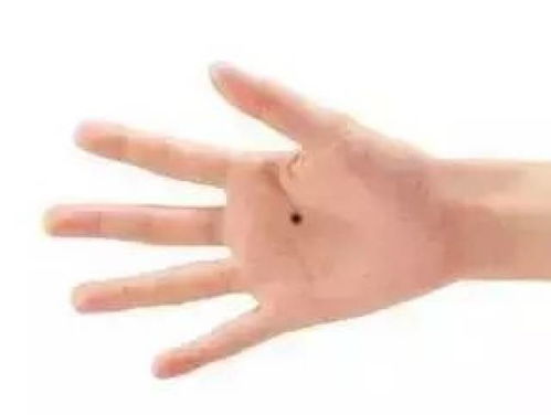女人身上的8种福痣,快看看你有几颗