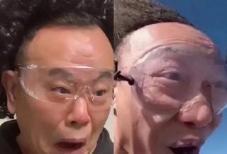 男星发际线大赏