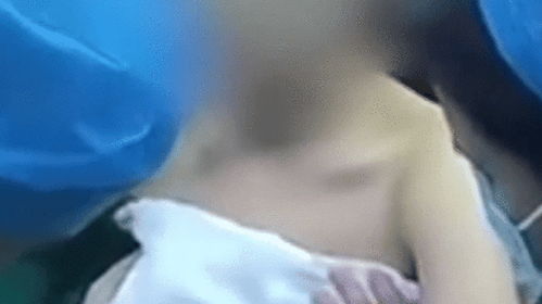 女子隆胸时全麻全程被医生偷拍现场视频流出