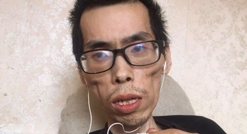 3天内两位抗癌博主病逝,抗癌经历励志,留给年轻人几点警示