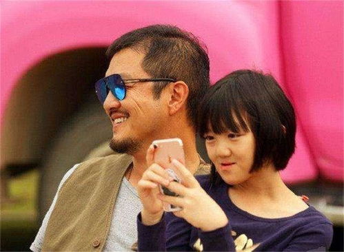 李嫣第三次兔唇微整,术后颜值恢复,网友看完照片不想说话了