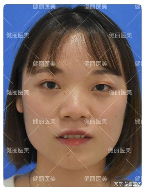 为啥会大小眼这两个原因很多人都不知道