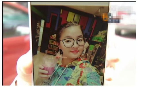 做双眼皮后,女子经常被人说是另类,医院你面部表情太丰富