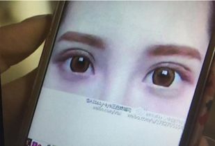 西安女子割双眼皮起两个大包美容院却人间蒸发