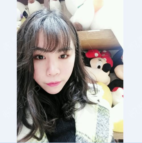 哈喽美女们晚上好,今天虽然天气不好,但是还是要美美...面部填充悦美整形